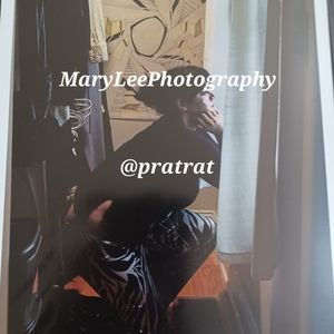 More Face stitches after another seizure